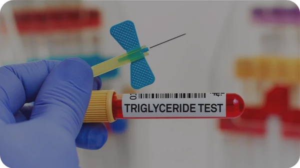 Trigliceridi alti: valori e indicazioni generali (2025)