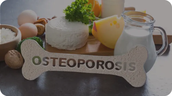 Alimentazione e osteoporosi
