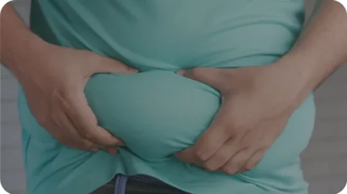 Resistenza insulinica e obesità addominale